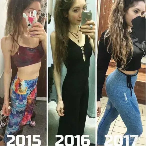 極致追求瘦身，反而患上疾病，一天嘔吐14次