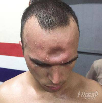 為什么終止比賽？我還沒打夠呢！