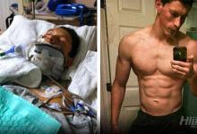 19歲小伙車(chē)禍后成殘廢！恢復(fù)性訓(xùn)練重新站起來(lái)變型男