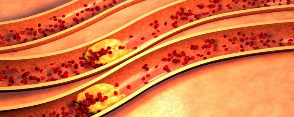 世界上最胖的人減了660斤 肥胖有哪些危害-易網<a href=http://www.xllyou.com/ target=_blank class=infotextkey>健康養生</a>網 世界上最胖的人減了660斤 肥胖有哪些危害