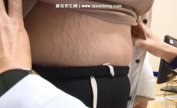 司美格魯肽注射減肥有副作用嗎多少錢,550元正常人打很危險-易網<a href=http://www.xllyou.com/ target=_blank class=infotextkey>健康養生</a>網 司美格魯肽注射減肥有副作用嗎多少錢,550元正常人打很危險