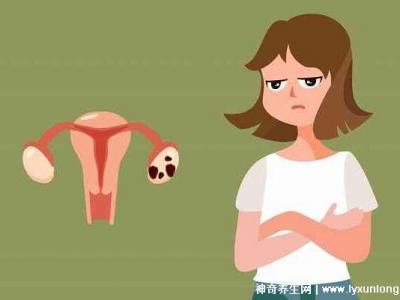 子宮肌瘤最怕三個運動，激烈的運動和夫妻生活導致肌瘤增大