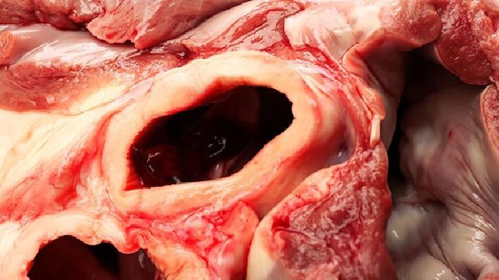 減肥能吃帶魚嗎？減肥期間吃帶魚需要注意什么？