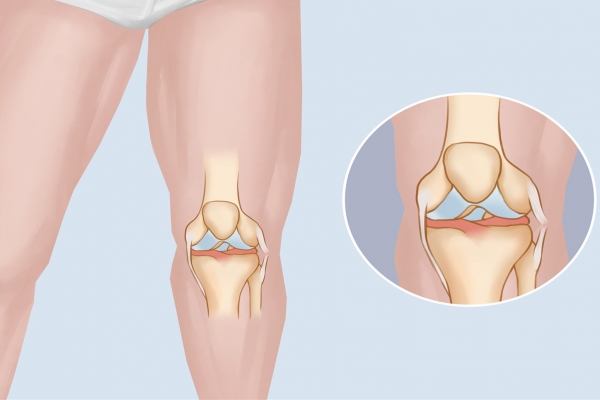 半馬對身體有損傷嗎-易網<a href=http://www.xllyou.com/ target=_blank class=infotextkey>健康養生</a>網 半馬對身體有損傷嗎