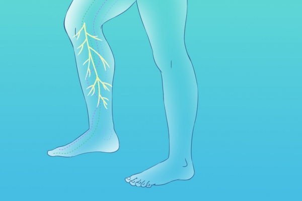 瘦小腿的方法有哪些-易網<a href=http://www.xllyou.com/ target=_blank class=infotextkey>健康養生</a>網 瘦小腿的方法有哪些