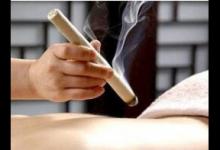 艾灸也可美容 這四種女性尤其適合