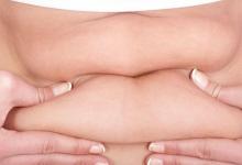 腰部贅肉很煩惱 吸脂減肥會不會反彈？