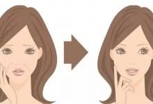 法令紋能去除嗎？去除法令紋的方法有哪些？