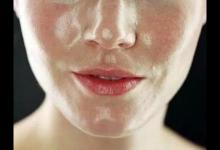 油性皮膚如何改善?皮膚科醫(yī)生有4個(gè)建議!