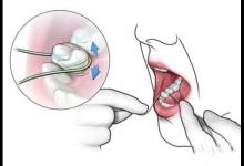 健康公開課:天天塞牙?使用牙線的“三步走”戰略送給你