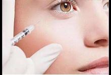 玻尿酸豐臥蠶有哪些優勢和副作用?