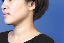 消除頸紋的按摩手法 一學就會