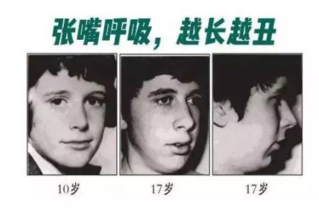 這些讓你變丑的習慣,再不改那可就沒救了! 這些讓你變丑的習慣,再不改那可就沒救了!