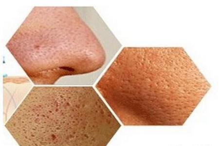 護膚界的五大騙局，千萬注意避免