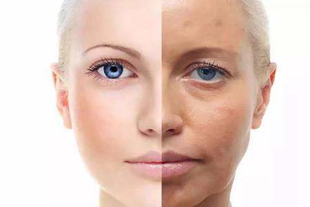 痘痘肌膚、干皮、油皮膚質(zhì)大不同,護(hù)膚方法有訣竅-易網(wǎng)<a href=http://www.xllyou.com/ target=_blank class=infotextkey>健康養(yǎng)生</a>網(wǎng) 痘痘肌膚、干皮、油皮膚質(zhì)大不同,護(hù)膚方法有訣竅