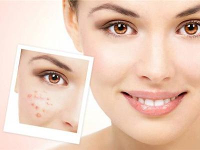 四大肌膚護(hù)理秘訣,生活護(hù)膚必備技能