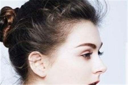 魚尾紋形成的原因是什么?怎樣才能有效去除-易網健康養生網 魚尾紋形成的原因是什么?怎樣才能有效去除