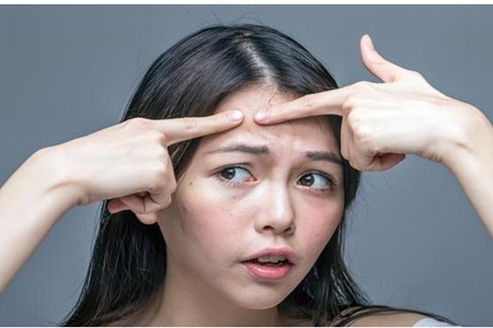 女生額頭長痘的原因，對癥下藥才能有干凈肌膚