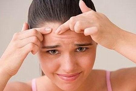 女生額頭長痘的原因，對癥下藥才能有干凈肌膚