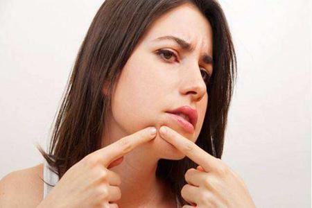 痘痘長在嘴角周圍是怎么一回事,女性清痘只需三招-易網健康養生網 痘痘長在嘴角周圍是怎么一回事,女性清痘只需三招