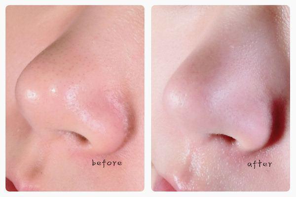 面膜起泡泡怎么回事?其原理是什么?-易網健康<a href=http://www.xllyou.com/jkys/ target=_blank class=infotextkey>養生</a>網 面膜起泡泡怎么回事?其原理是什么?