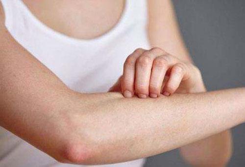 為什么皮膚會出現過敏性瘙癢?幫你揪出4個元兇-易網健康<a href=http://www.xllyou.com/jkys/ target=_blank class=infotextkey>養生</a>網 為什么皮膚會出現過敏性瘙癢?幫你揪出4個元兇