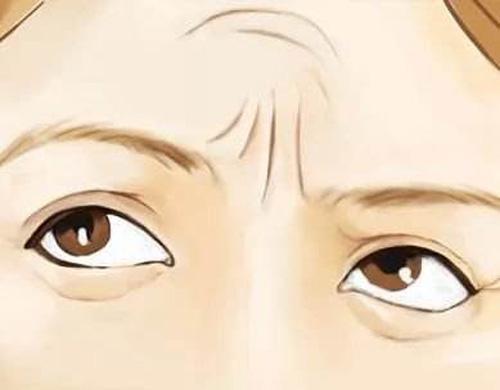 抬頭紋顯老怎么辦?5個方法搞定它