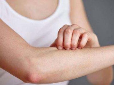 為什么皮膚會出現過敏性瘙癢？幫你揪出4個元兇