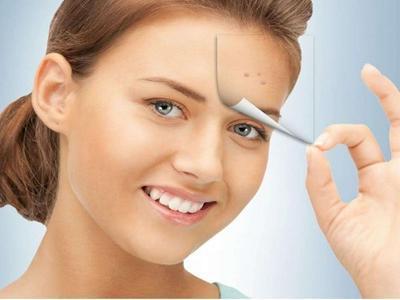 引起額頭長痘的原因,女生臉上突然爆痘的五個緊急護理方法