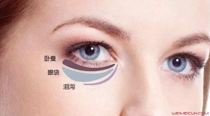 怎樣去除眼袋最有效的方法是什么 幾個實用小妙招推薦-易網<a href=http://www.xllyou.com/ target=_blank class=infotextkey>健康養生</a>網 怎樣去除眼袋最有效的方法是什么 幾個實用小妙招推薦