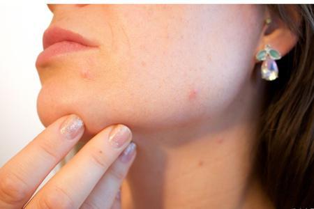 臉上七處長痘痘的位置圖解，一直長痘原來是這里出現毛病