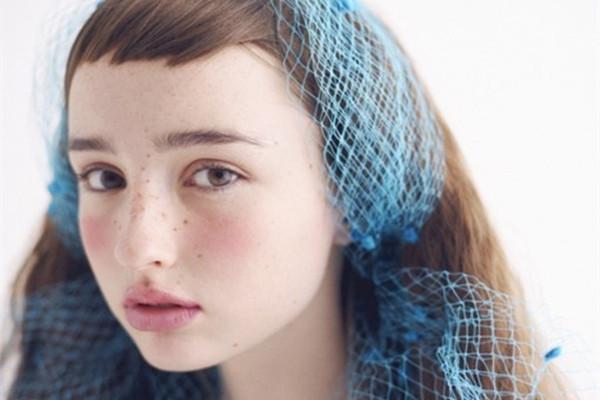 激光祛斑會反彈嗎?真的有效果嗎?