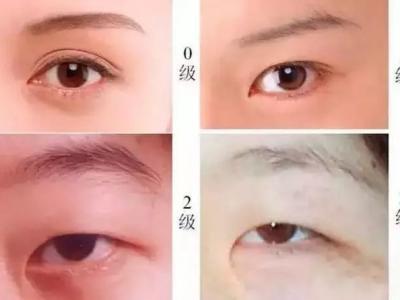 雙眼皮貼是在眼影之前還是之后？眼妝注意事項有哪些？