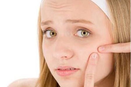 女生30歲臉上長痘痘的原因,長痘痘效果最佳的治療方法-易網健康養生網 女生30歲臉上長痘痘的原因,長痘痘效果最佳的治療方法