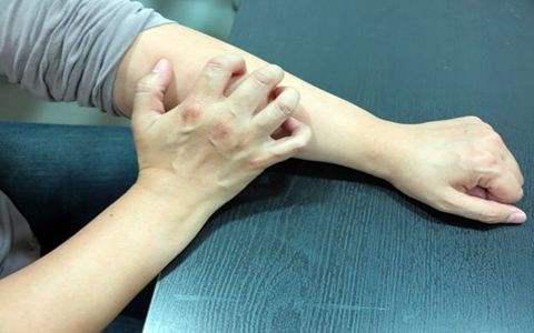 冬季皮膚瘙癢是怎么回事? 可能是6個因素在作怪