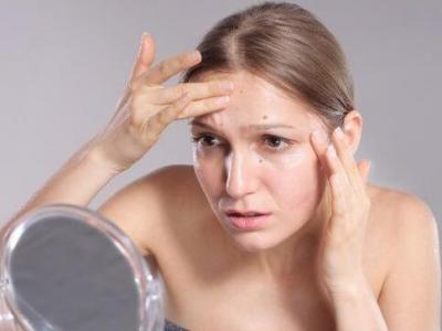 面部頻繁起痘是怎么回事?這4個(gè)原因要注意