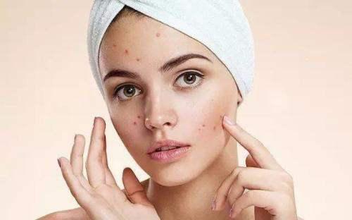 臉上長閉口怎么辦? 光做好清潔皮膚還不夠！