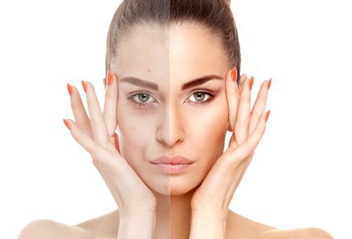 額頭長(zhǎng)痘的原因及調(diào)理方法 杜絕痘痘橫行-易網(wǎng)<a href=http://www.xllyou.com/ target=_blank class=infotextkey>健康養(yǎng)生</a>網(wǎng) 額頭長(zhǎng)痘的原因及調(diào)理方法 杜絕痘痘橫行