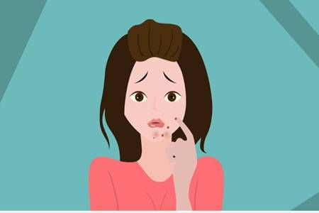 女生下巴長痘的原因,教你六個訣竅簡單祛痘-易網健康<a href=http://www.xllyou.com/jkys/ target=_blank class=infotextkey>養生</a>網 女生下巴長痘的原因,教你六個訣竅簡單祛痘