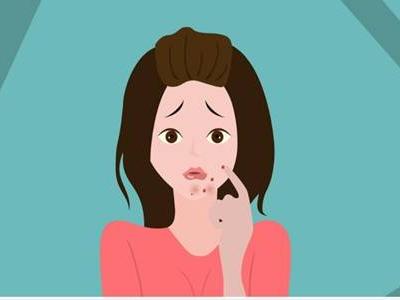 女生下巴長痘的原因，教你六個訣竅簡單祛痘