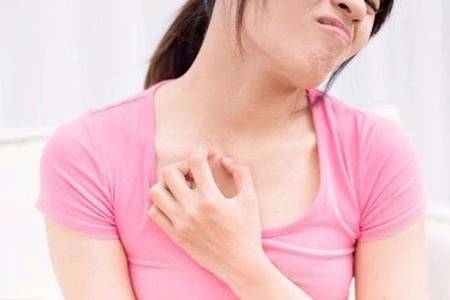 濕疹怎么治好得快？輕微濕疹和重度濕疹治療方式要區別對待