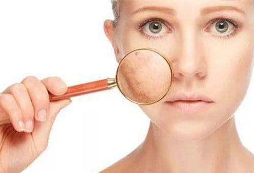 春季容易皮膚瘙癢 原來是這4個原因造成的!-易網健康養生網 春季容易皮膚瘙癢 原來是這4個原因造成的!