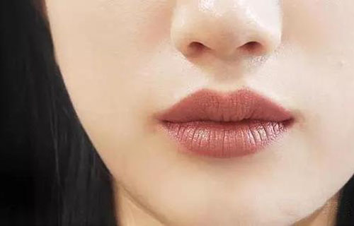 嘴唇邊緣顏色深如何淡化?淡化唇色的方法-易網健康養生網 嘴唇邊緣顏色深如何淡化?淡化唇色的方法