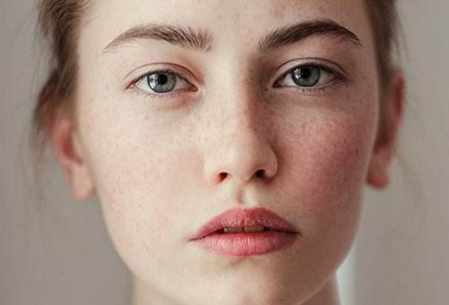 臉上長黃褐斑怎么祛除 3個妙招改善黃褐斑問題-易網健康<a href=http://www.xllyou.com/jkys/ target=_blank class=infotextkey>養生</a>網 臉上長黃褐斑怎么祛除 3個妙招改善黃褐斑問題