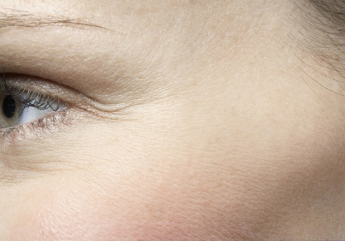 怎樣消除眼部細紋 做到這幾點有效改善細紋-易網健康<a href=http://www.xllyou.com/jkys/ target=_blank class=infotextkey>養生</a>網 怎樣消除眼部細紋 做到這幾點有效改善細紋