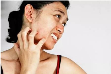 臉過敏發紅癢怎么辦，緊急護膚方法保濕消紅腫