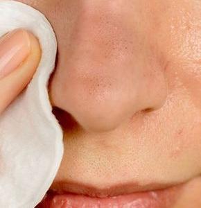 毛孔時(shí)常堵塞 真希望有個(gè)如毛孔吸塵器一般的單品！