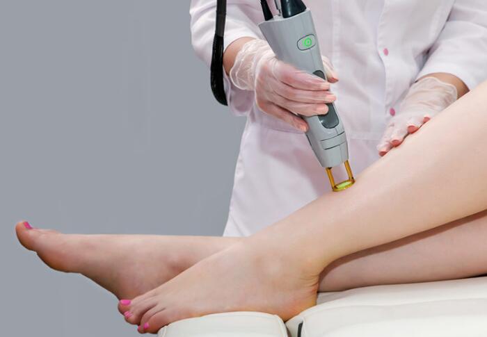 激光脫毛手術真的可以永遠去除汗毛嗎？永久去除汗毛的方法