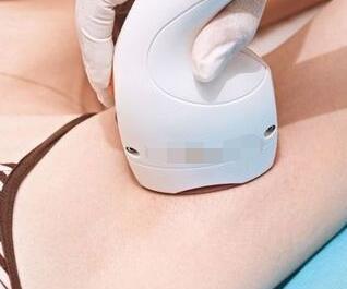 激光脫毛有用嗎？激光脫毛是永久性的嗎？