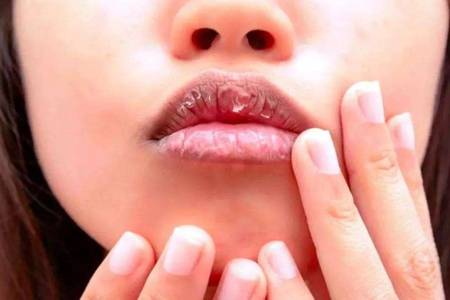 嘴唇干裂脫皮怎么辦,六個(gè)潤(rùn)唇方法養(yǎng)護(hù)嬌嫩嘴唇-易網(wǎng)健康<a href=http://www.xllyou.com/jkys/ target=_blank class=infotextkey>養(yǎng)生</a>網(wǎng) 嘴唇干裂脫皮怎么辦,六個(gè)潤(rùn)唇方法養(yǎng)護(hù)嬌嫩嘴唇